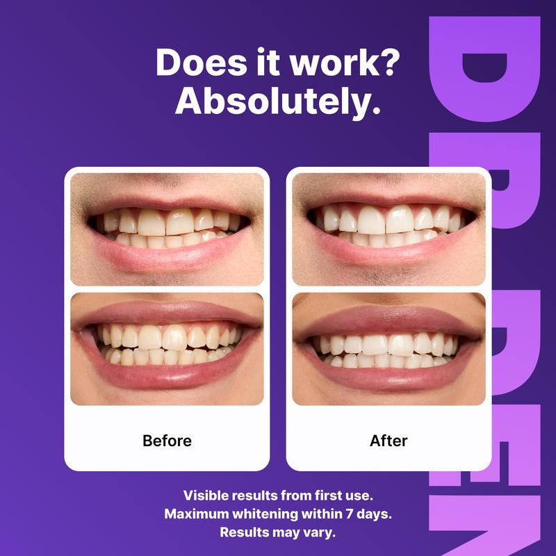 Elevate Your Smile with DRDENT Purple Teeth Whitening Strips - 7/21 Sessions for a Radiant, Enamel-Safe Shine - Perfect for Sensitive Teeth!