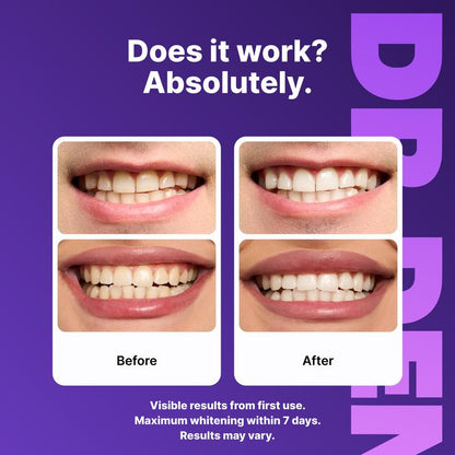 Elevate Your Smile with DRDENT Purple Teeth Whitening Strips - 7/21 Sessions for a Radiant, Enamel-Safe Shine - Perfect for Sensitive Teeth!